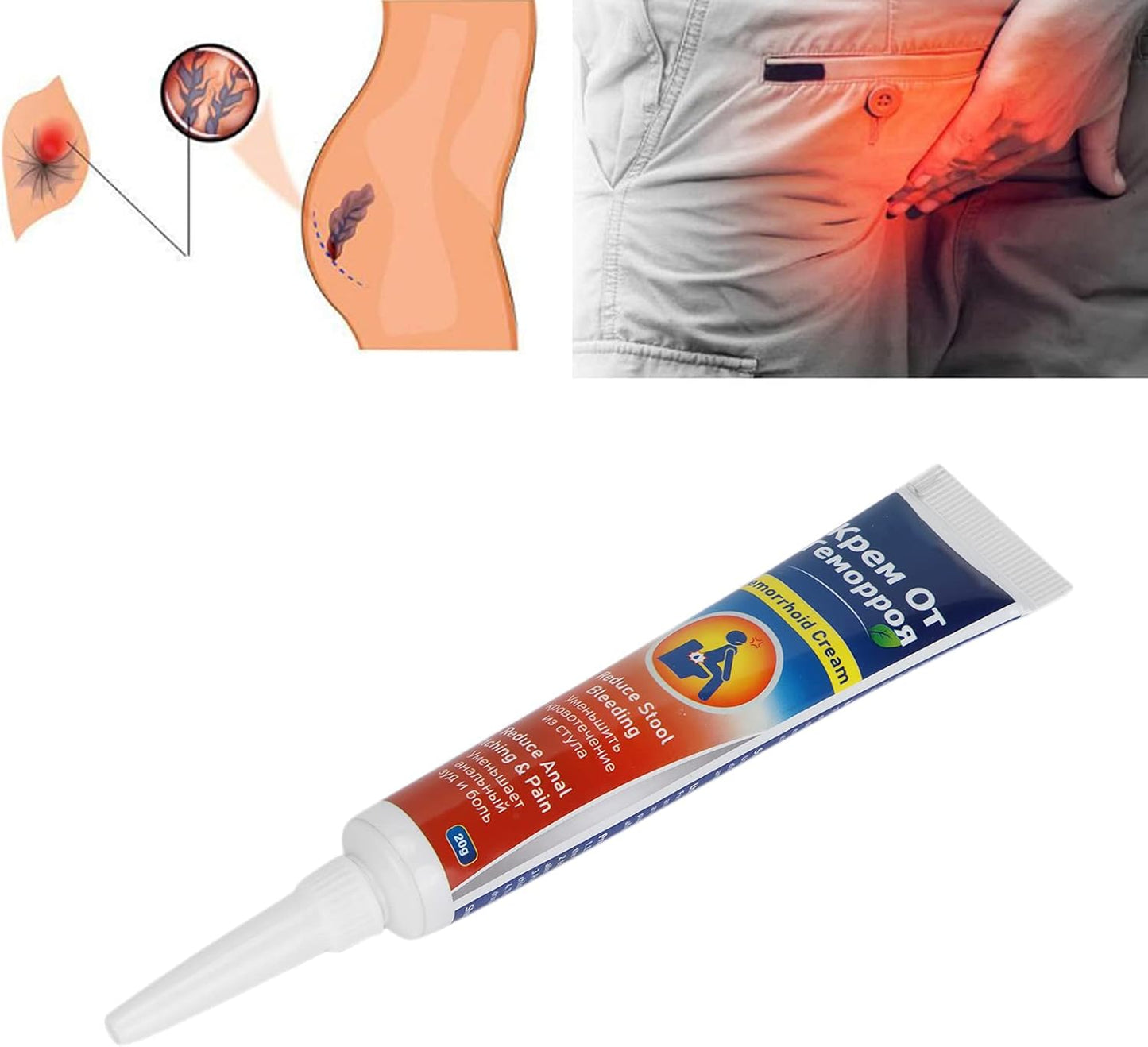 Crema para Hemorroides