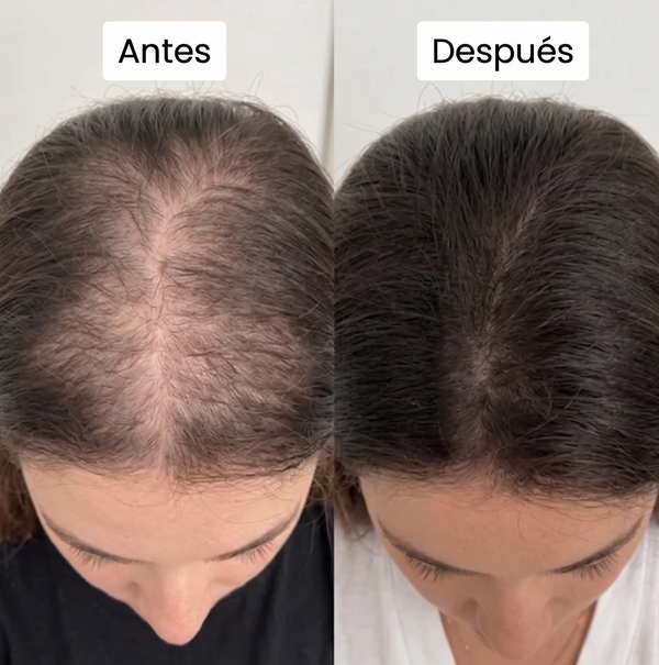 Resultado Antes y Después