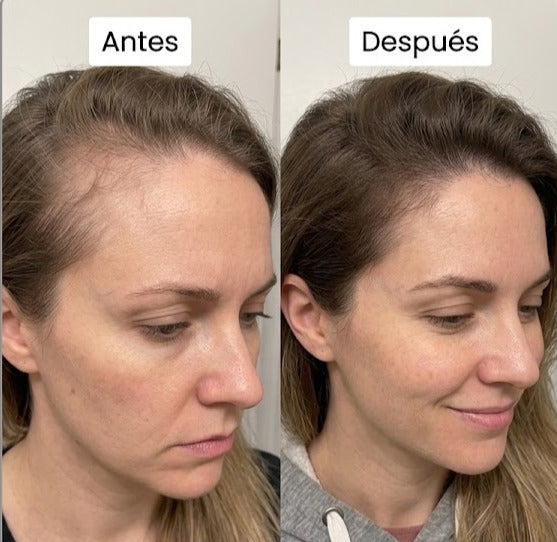 Resultado Antes y Después